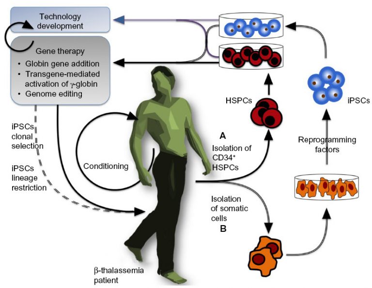 Gene therapy treatment for blood disease approved in Europe ...