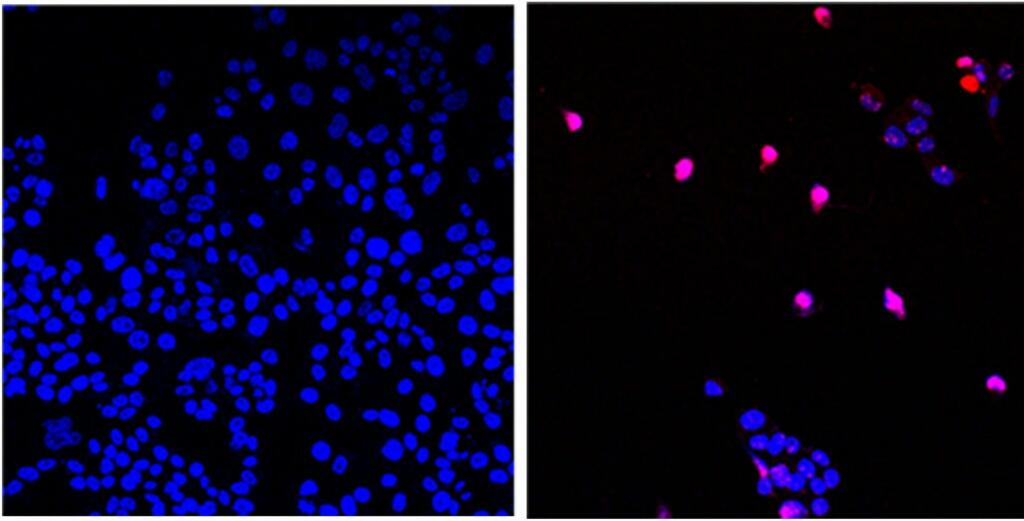 Promising Drug That Can Kill All Solid Tumor Cancers - Vimarsana News