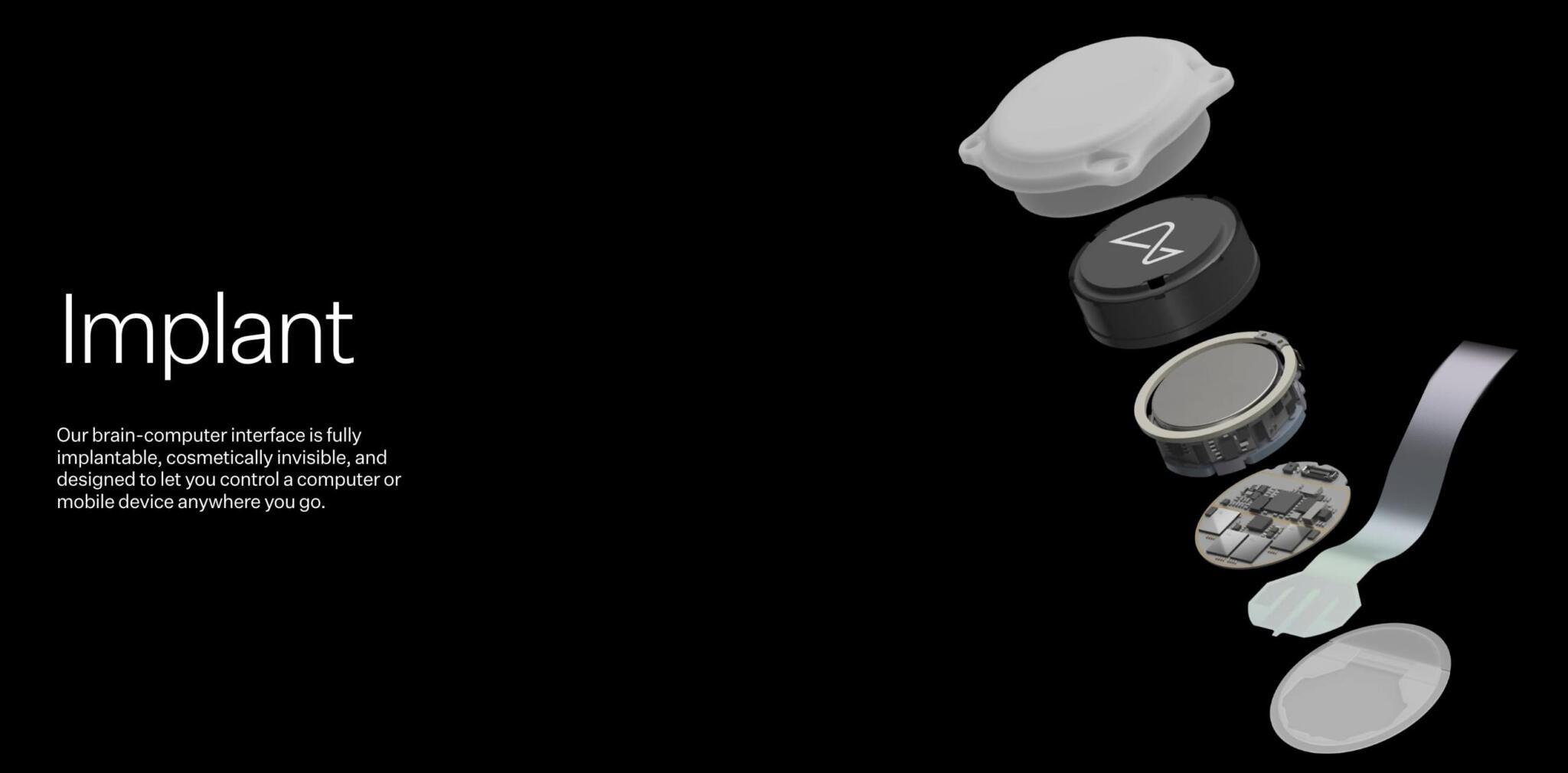 The First Human Has Gotten a Neuralink Implant | NextBigFuture.com