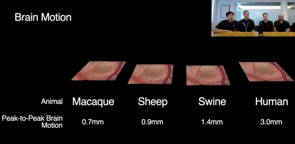 Neuralink Will Offer Telepathy and then Brain Control of
